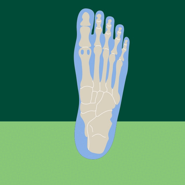 The Best Shoes for Morton’s Neuroma