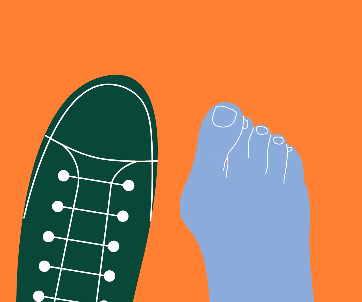 Understanding bunions: what they are and why shoes matter