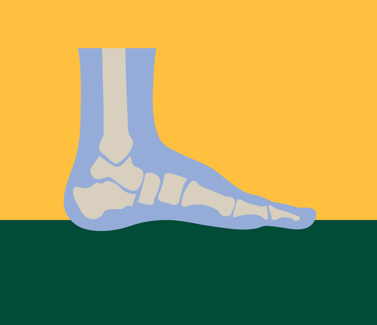 INNER ARCH FOOT PAIN