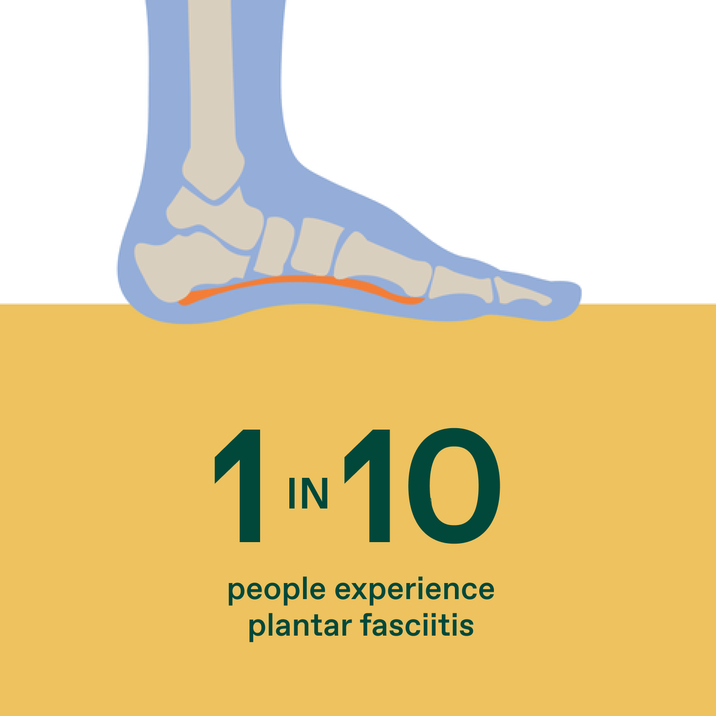 Choosing the Best Custom Moldable Orthopedic Insoles for Plantar Fasciitis