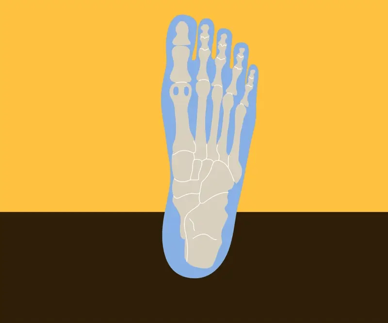 Shoppers With Morton’s Neuroma Say These Insoles Helped Get Rid of Their Pain — and They’re Finally Walking Comfortably Again