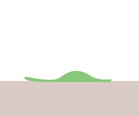 The benefits of arch support insoles