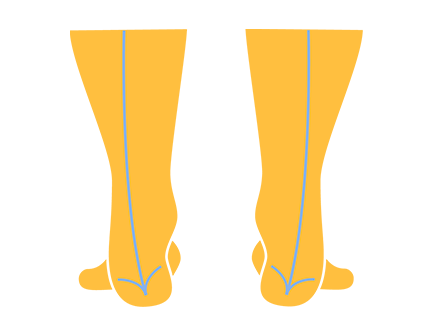 Best Supination Insoles: High-Arch Support and Everyday Stability Picks