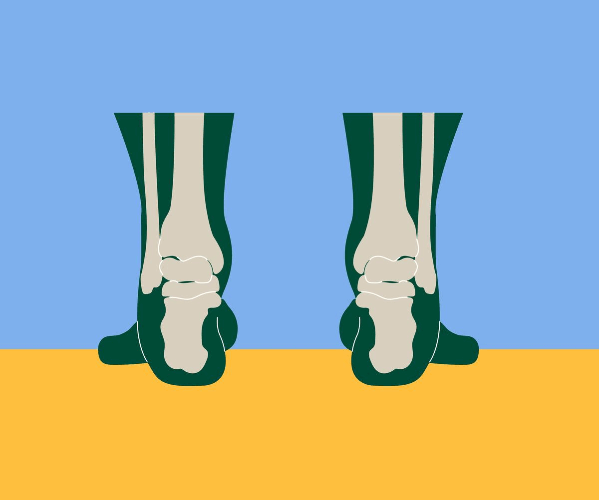 supination insoles