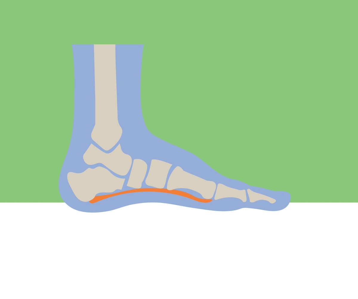 What to do with Plantar Fasciitis so bad I can't walk
